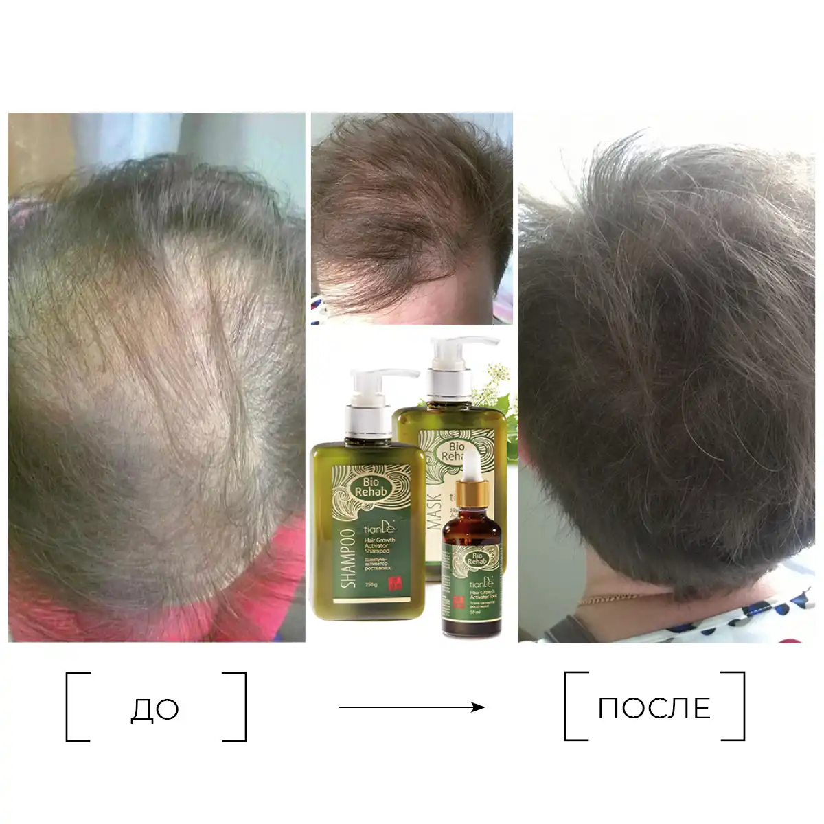 Mască-activator de creștere a părului, 250 g