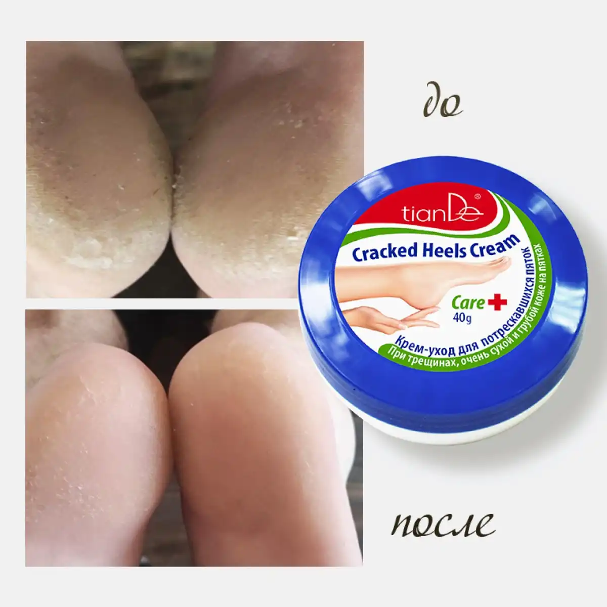 Cremă de îngrijire pentru călcâie crăpate