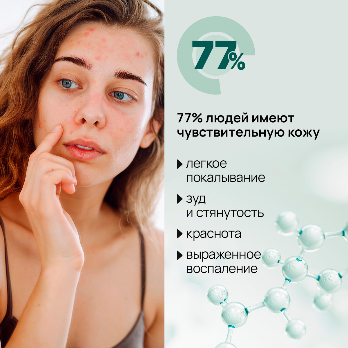 Восстанавливающая спрей-эссенция для лица с пробиотиками, 100 мл Thumbnail 3